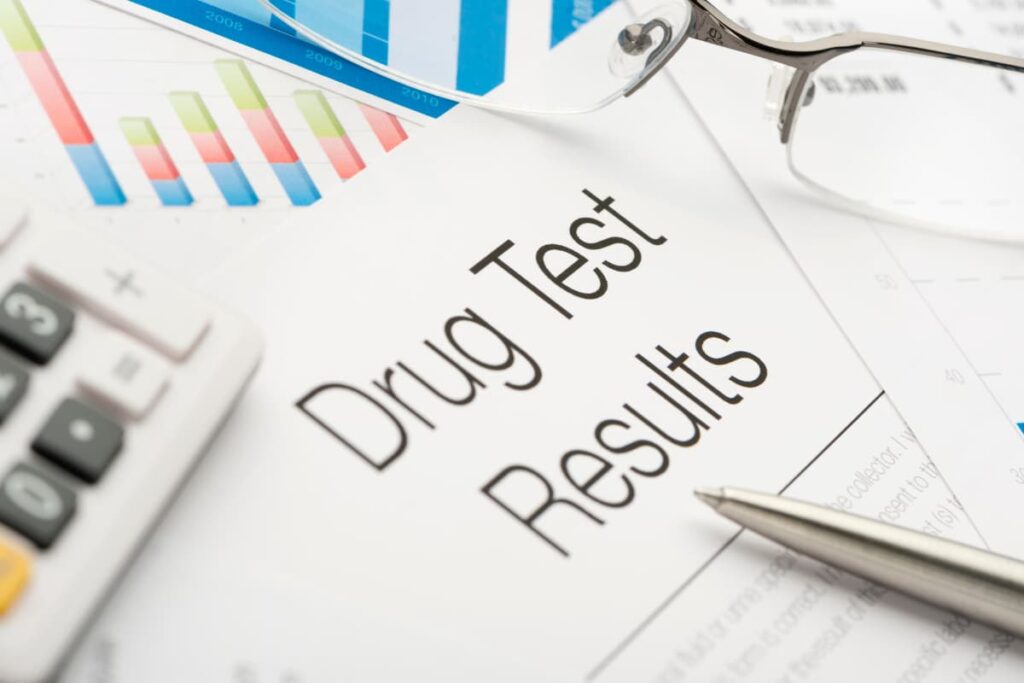 Does Tractor Supply Drug Test? (What, How To, Types Of)